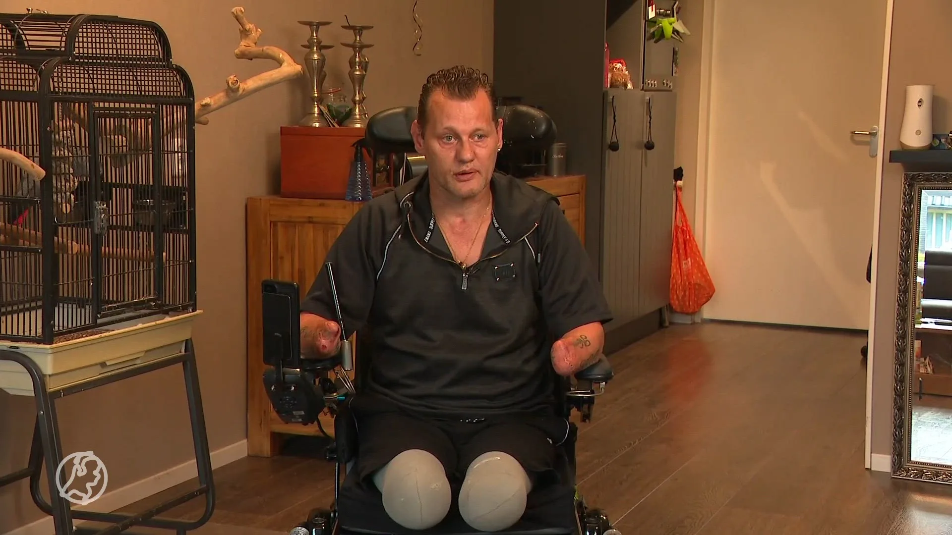 Michael werd wakker zonder armen en benen, nu wil hij weer stratenmaker worden