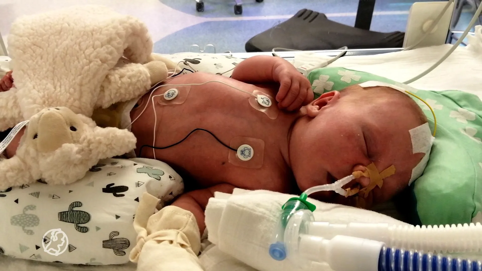 Eén op de 100 kinderen wordt geboren met een hartafwijking