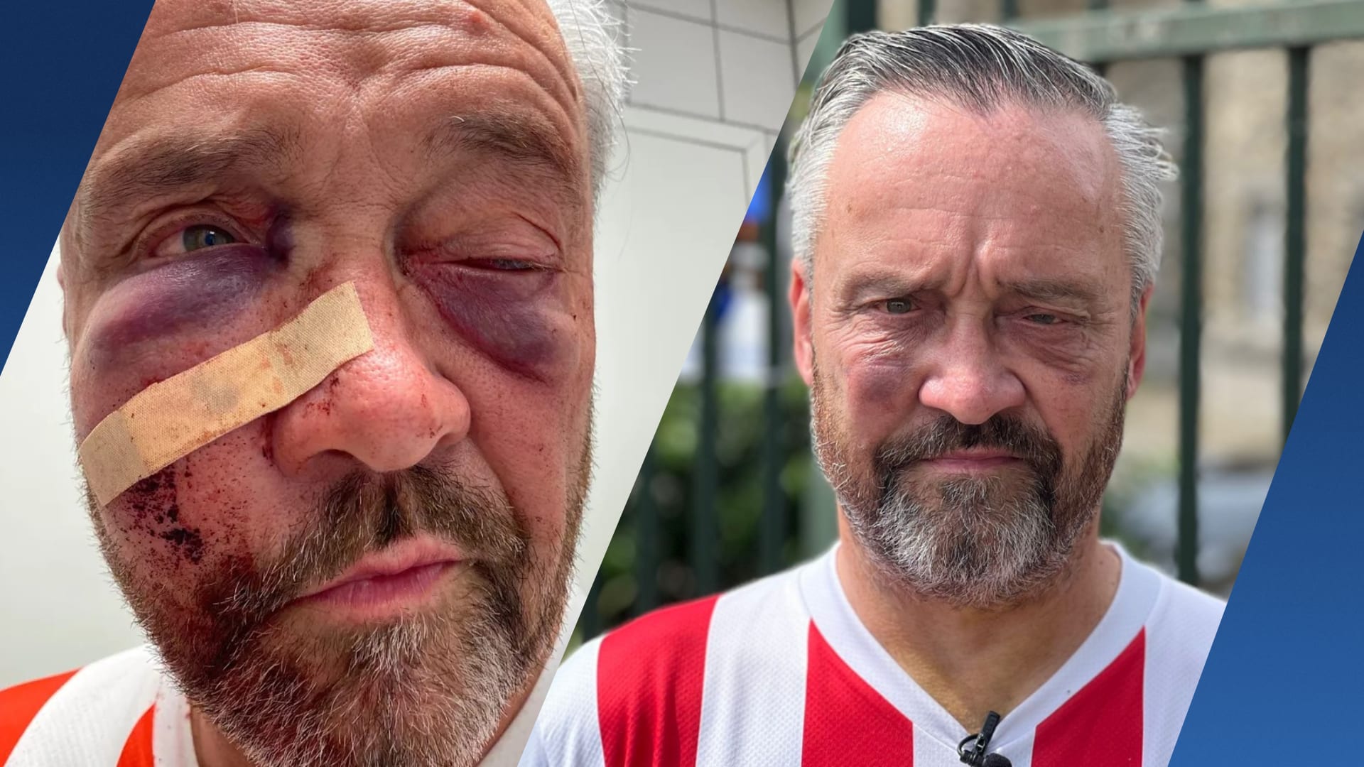 Anthony bewusteloos geslagen na kampioensfeest PSV: 'Ik durf niet meer naar buiten'