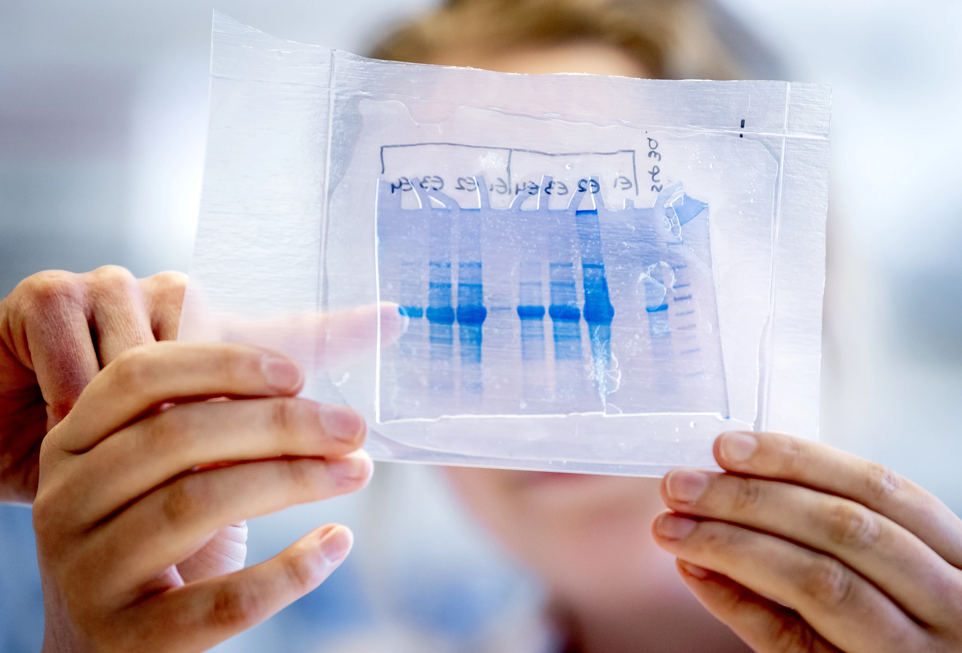 Onderzoekers vinden 'honderd keer sterker' antistof tegen coronavirus