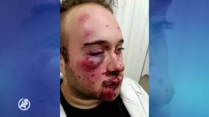 Politie duikt alsnog in mysterie rond toegetakelde Brian