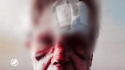 GEZOCHT: Vrouw (85) ernstig mishandeld door straatrover