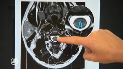 Twee jongeren deels verlamd in ziekenhuis Enschede door lachgas