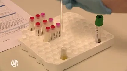 Erasmus MC: 'Therapie borstkanker en kurkuma gaan niet goed samen'