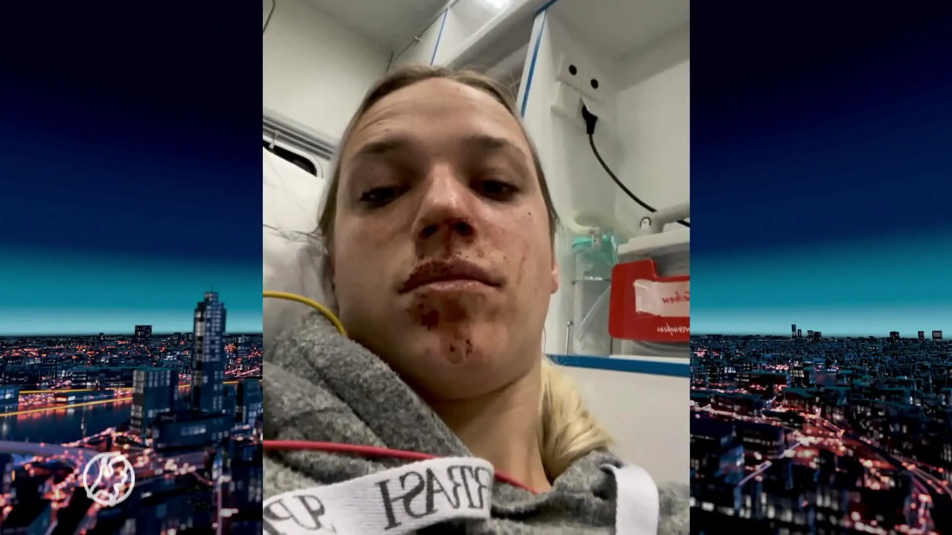 Tahnee (24) slachtoffer van brute woningoverval: vastgebonden...