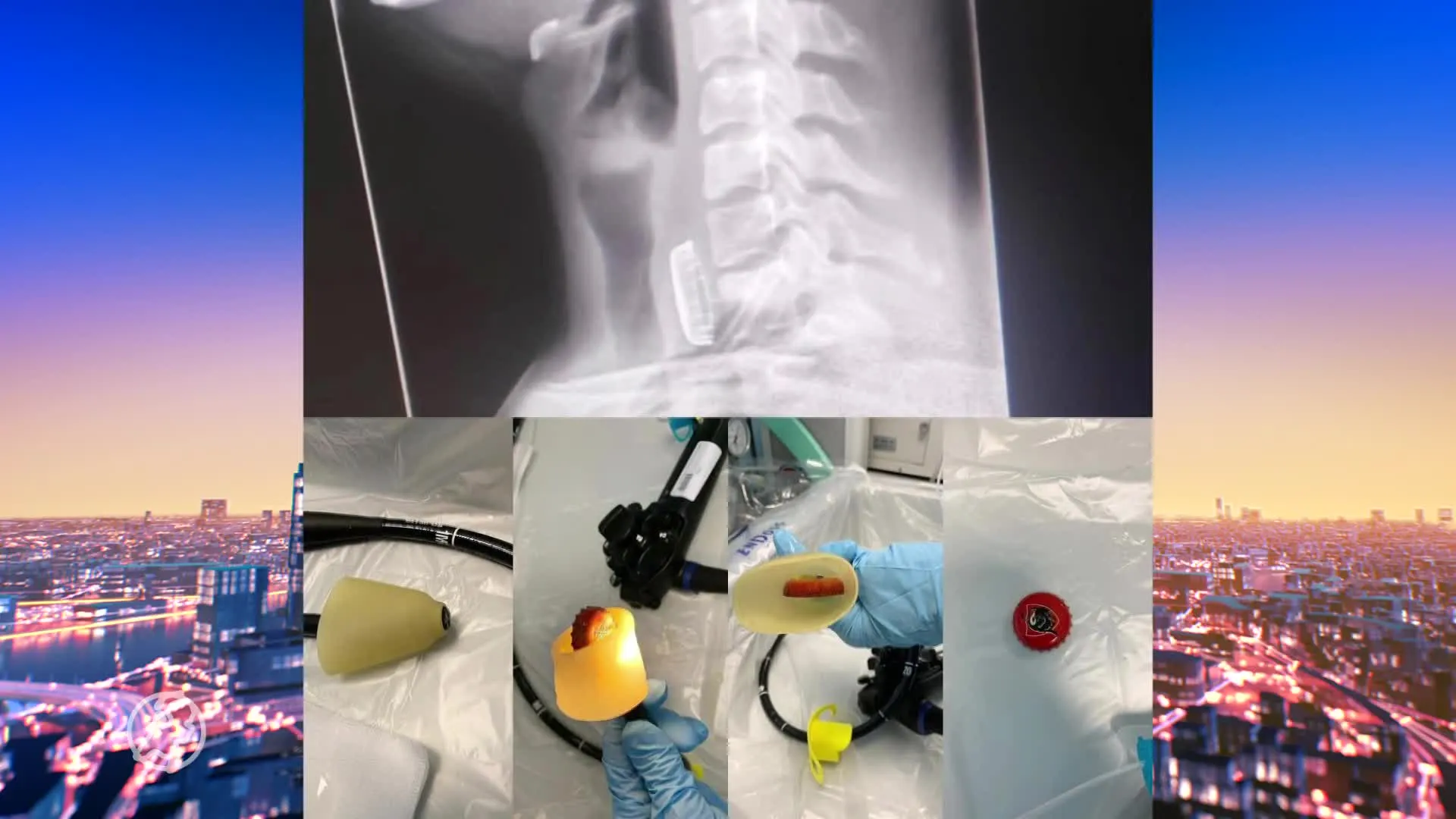 UMCG waarschuwt voor gevaarlijk drankspel dopje-dopje: 'Doe h...