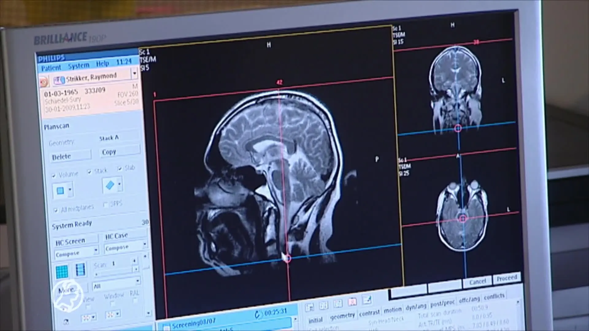 Flinke stijging van aantal kankerdiagnoses in 2021, na dip in coronajaar 2020