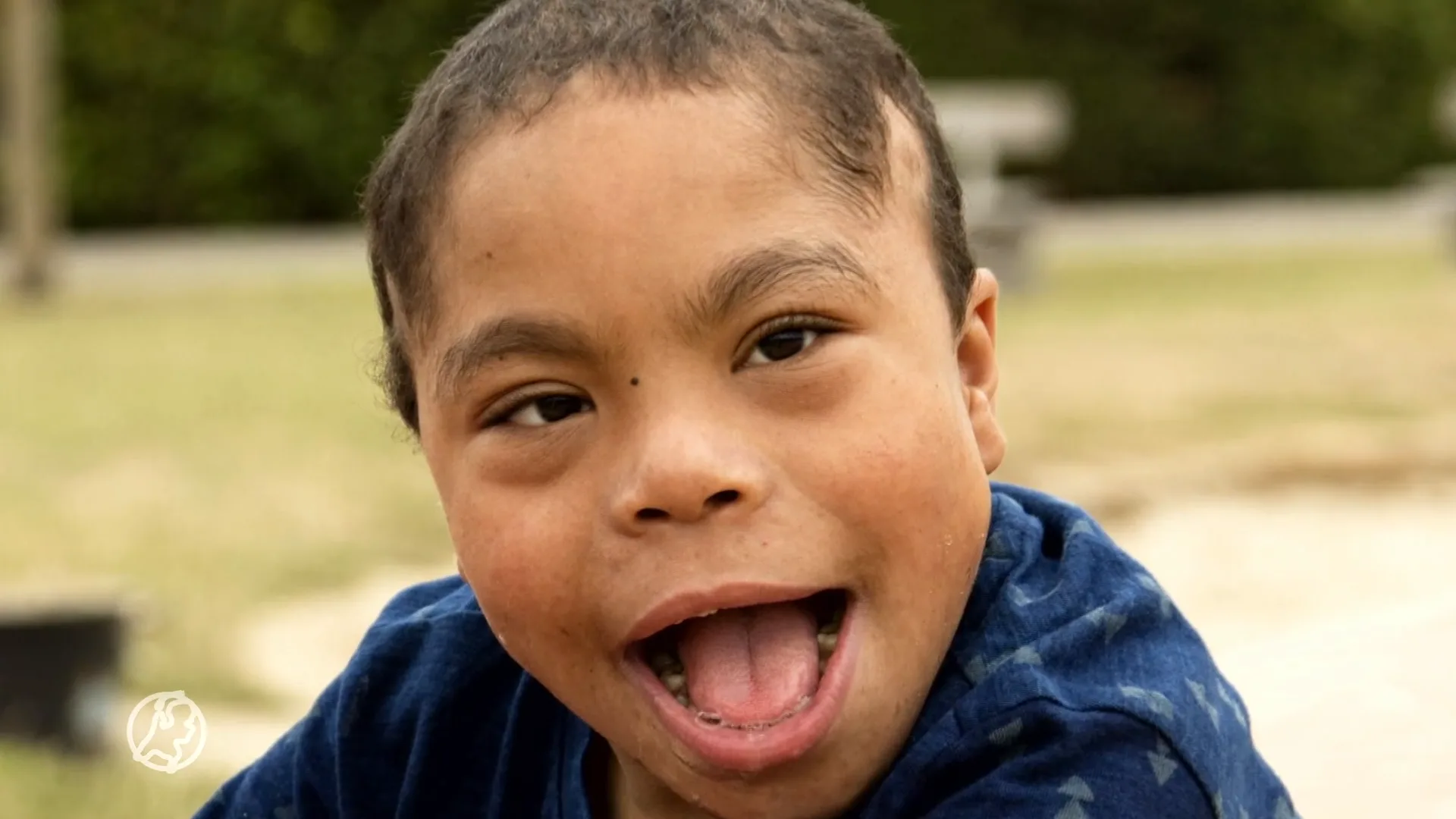 Pleegfamilie wil na jaren duidelijkheid over dood gehandicapte Zairo (14): 'Groot vraagteken'