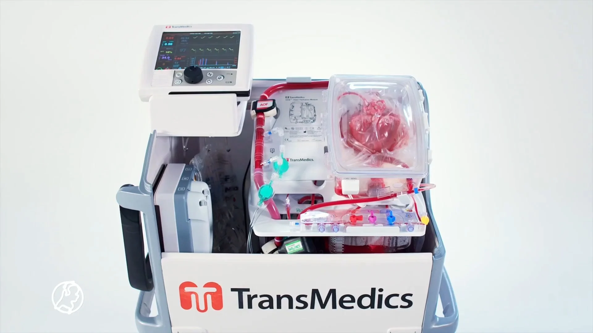 Transplantatie van hart dat niet meer klopt; nieuwe techniek ...