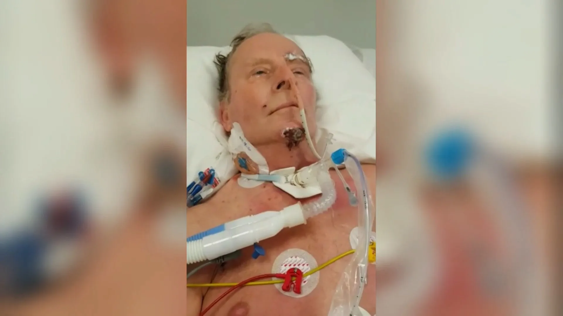 Frans (60) ontwaakte uit zijn coma van coronavirus: 'Ik heb z...