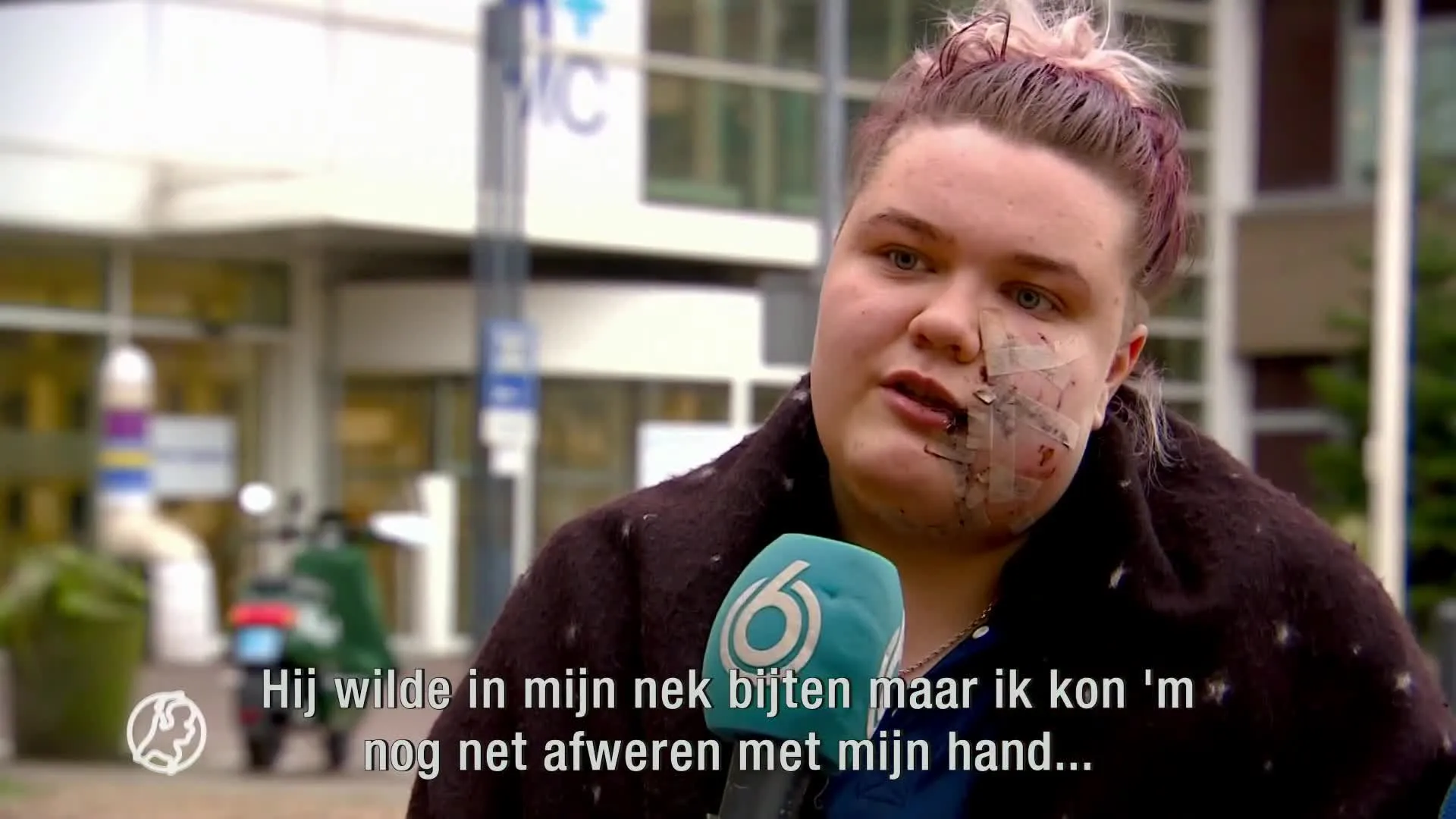 Taakstraf voor baasje van hond die Julia (18) in haar gezicht beet