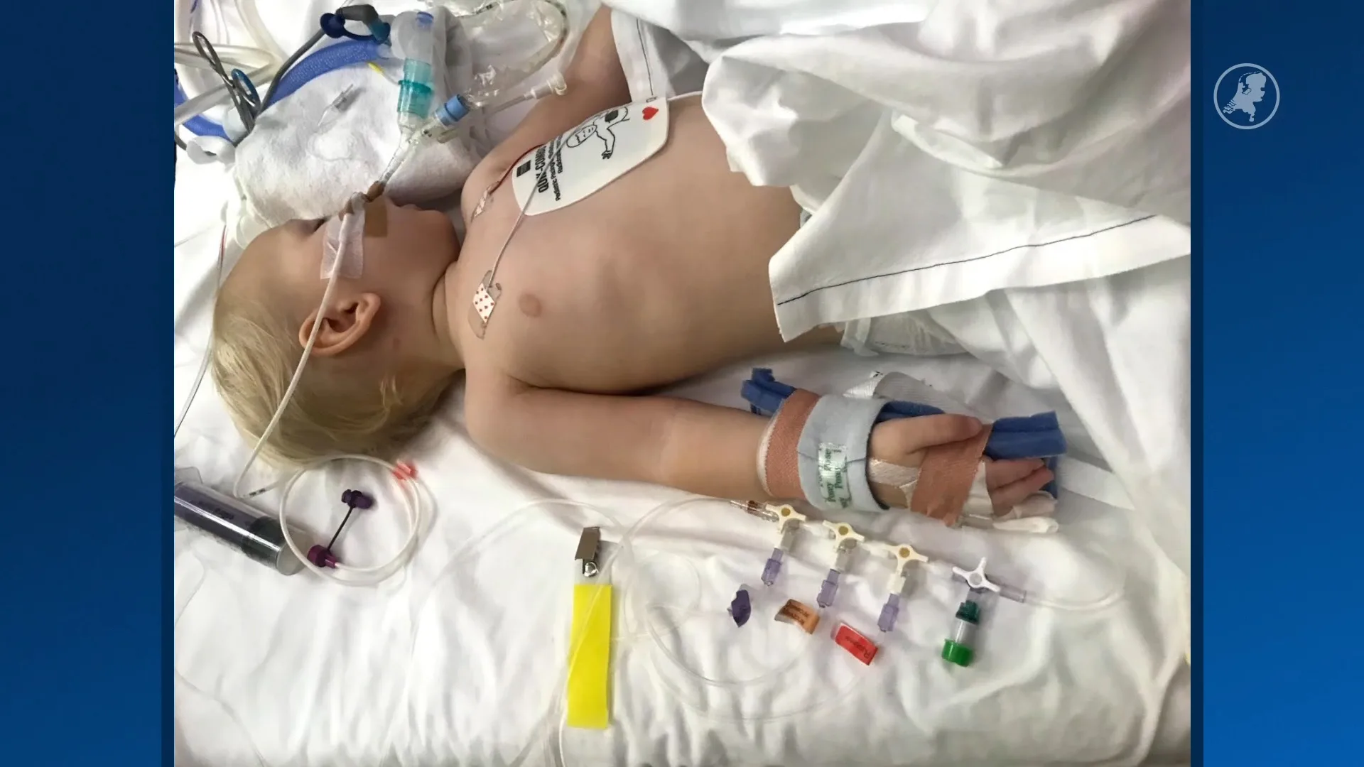 Juwe (7) werd levensgevaarlijk ziek na het inslikken van een knoopcelbatterij