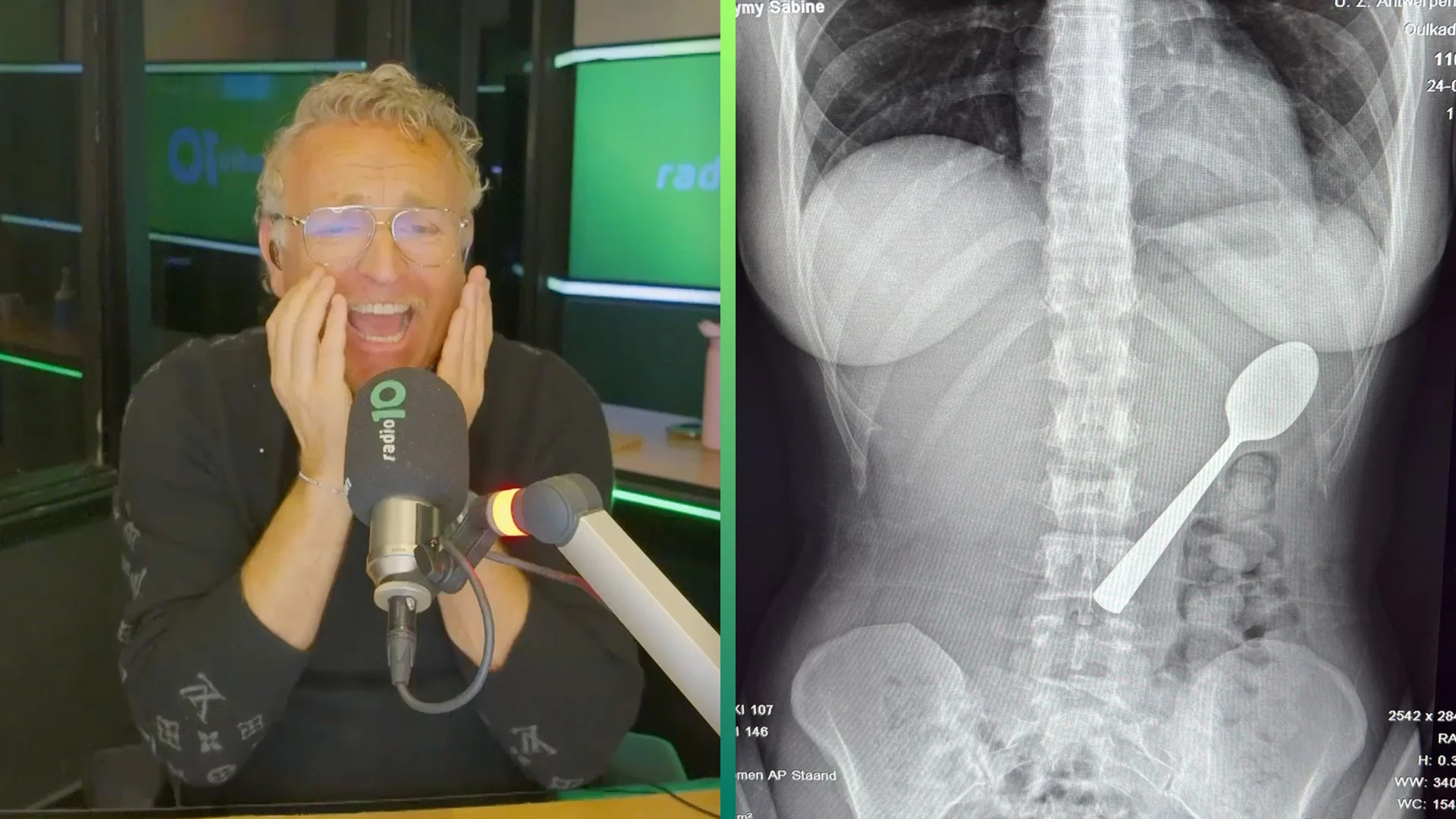 Reymy slikte een lepel van 17 centimeter in: 'Heeft er anderhalve dag ingezeten'