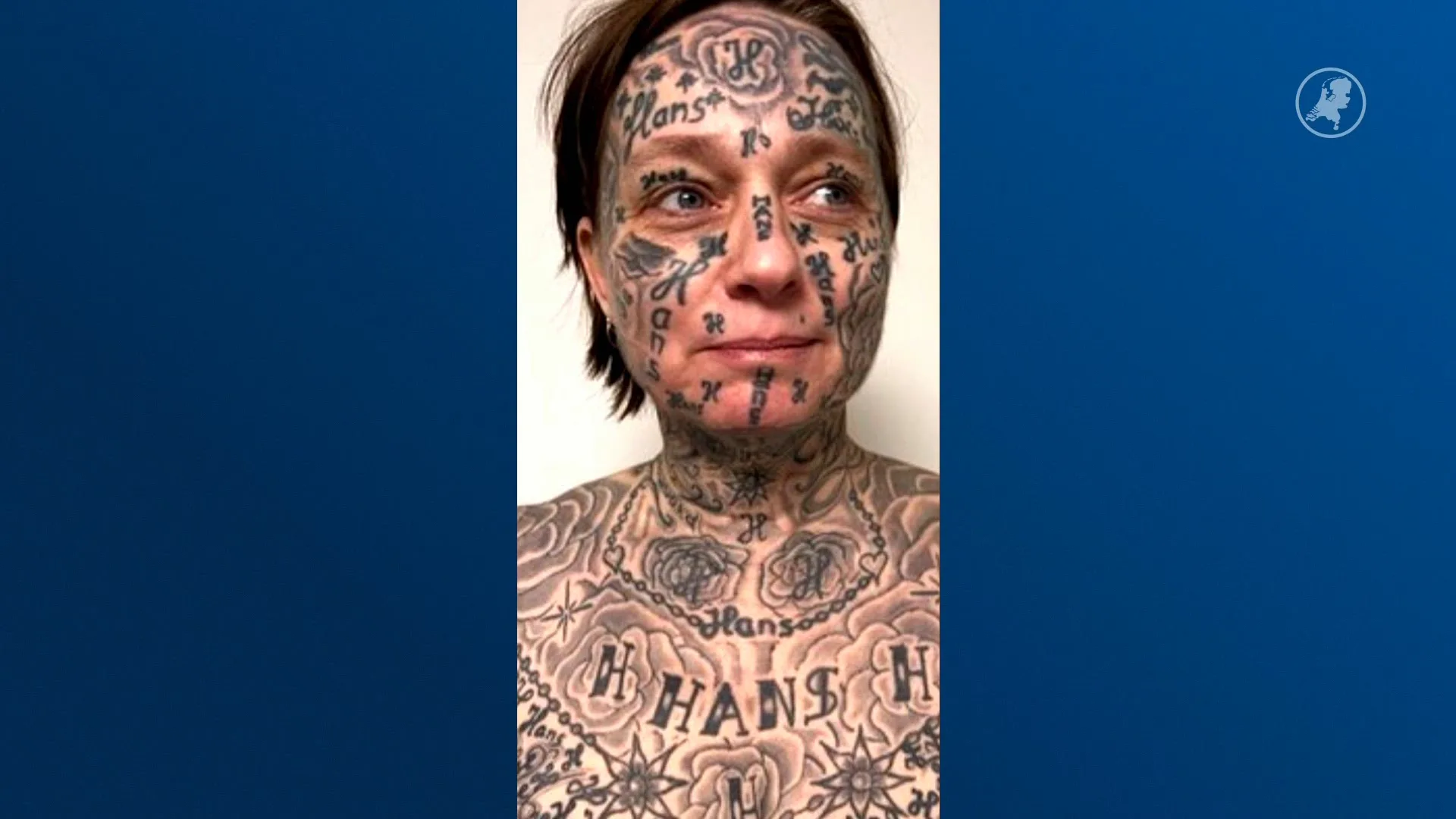 Crowdfunding om ongewenste tatoeages weg te laseren