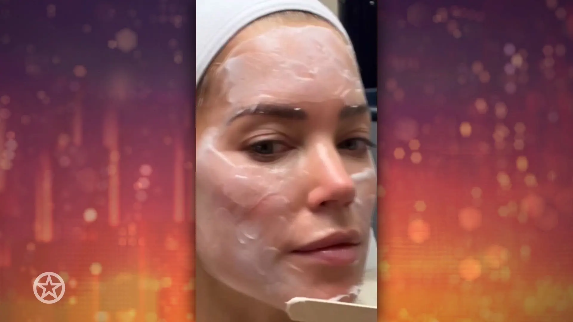 Sylvie Meis ondergaat heftige ingreep om huid te verbeteren