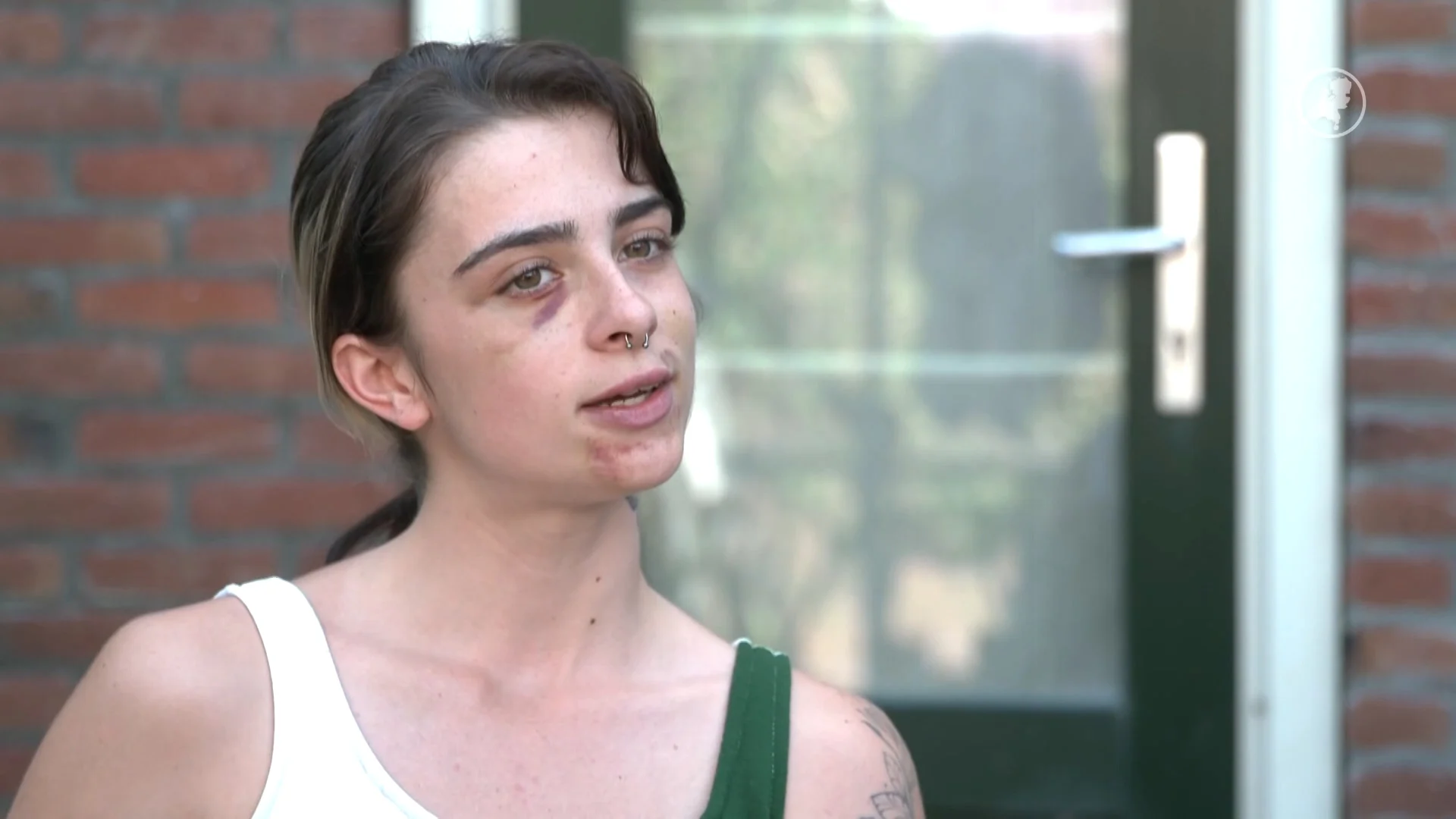 Lizzy (21) uit het niets zwaar mishandeld bij Veerplas