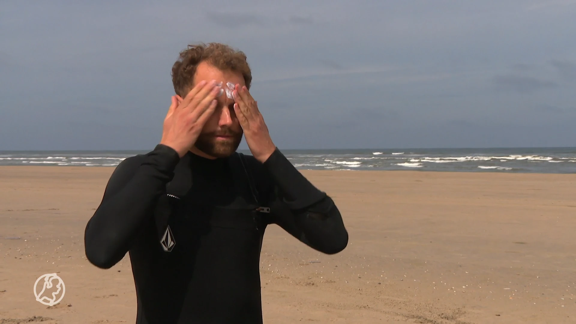 Erasmus MC ontwikkelt AI-model dat risico op huidkanker voorspelt: 'Kan bewustwording creëren'