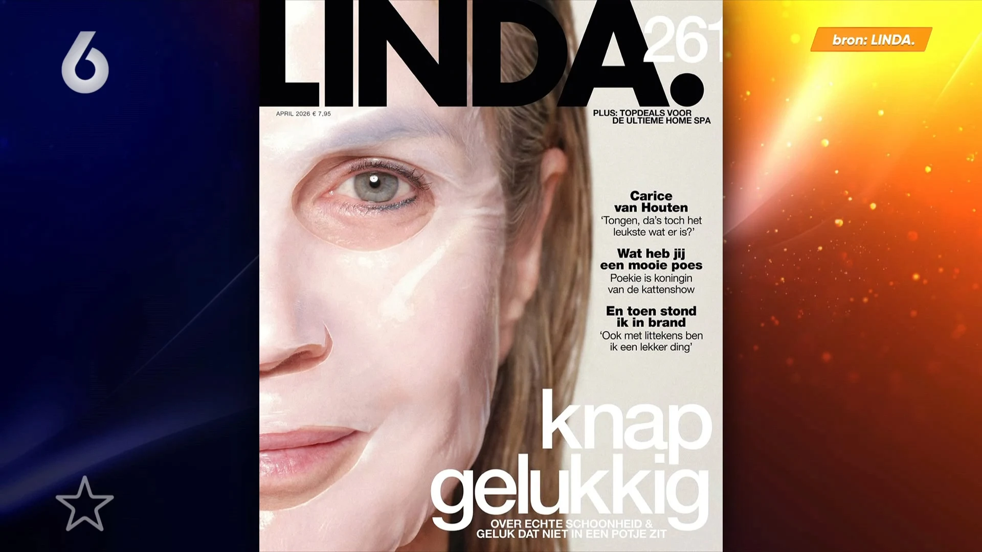 Linda de Mol doet boekje open over cosmetische ingrepen