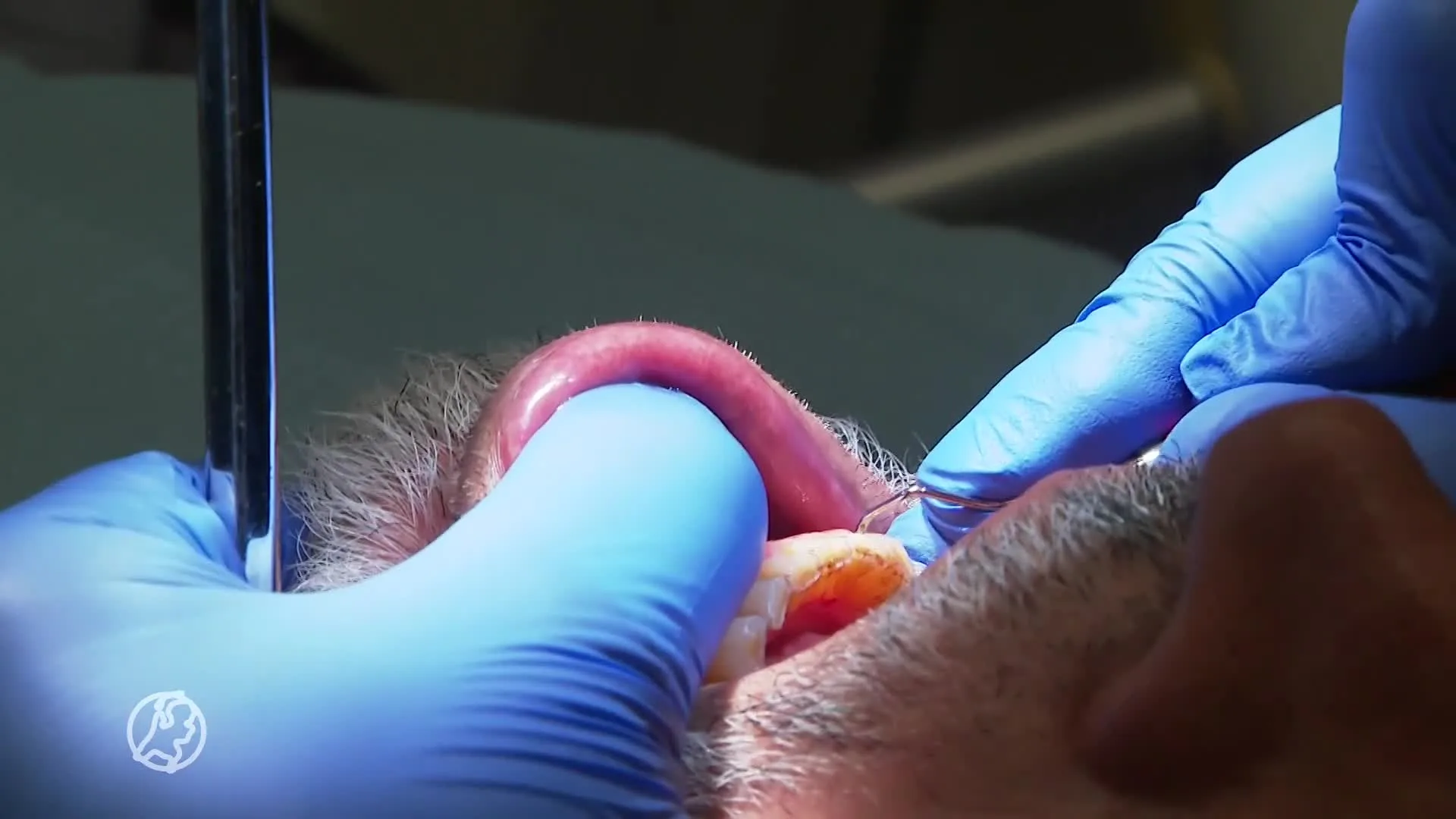 Mondzorg toch niet in de basispakket '1,5 miljoen mensen mijden mondzorg'