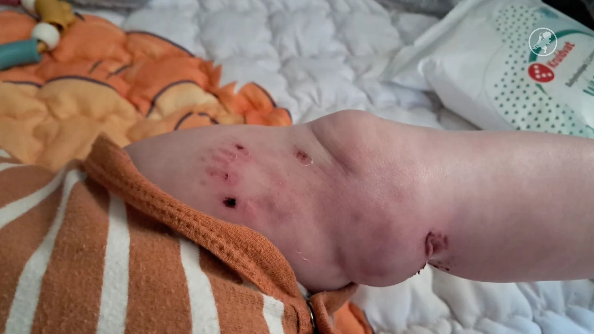 Gezin aangevallen door herdershonden in Coevorden, baby in beentje gebeten