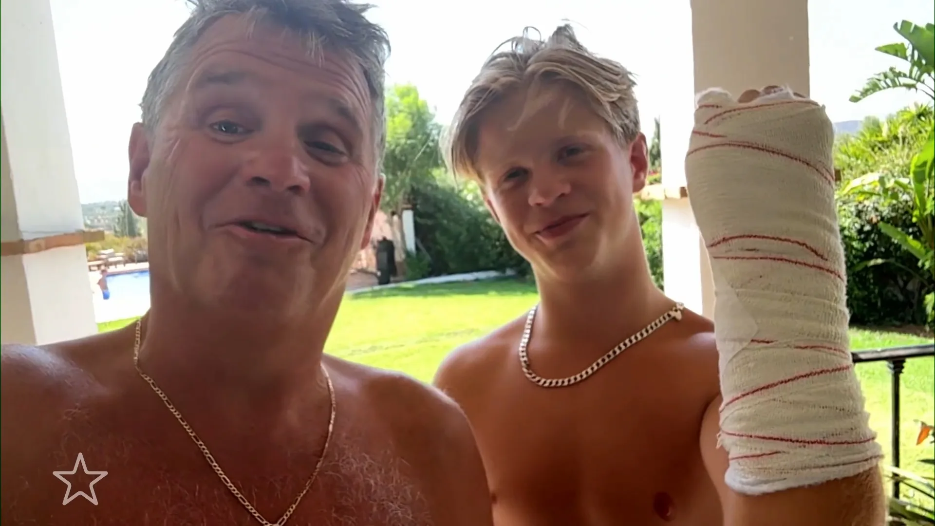 Zoon Wolter Kroes geeft update over afgesneden vinger