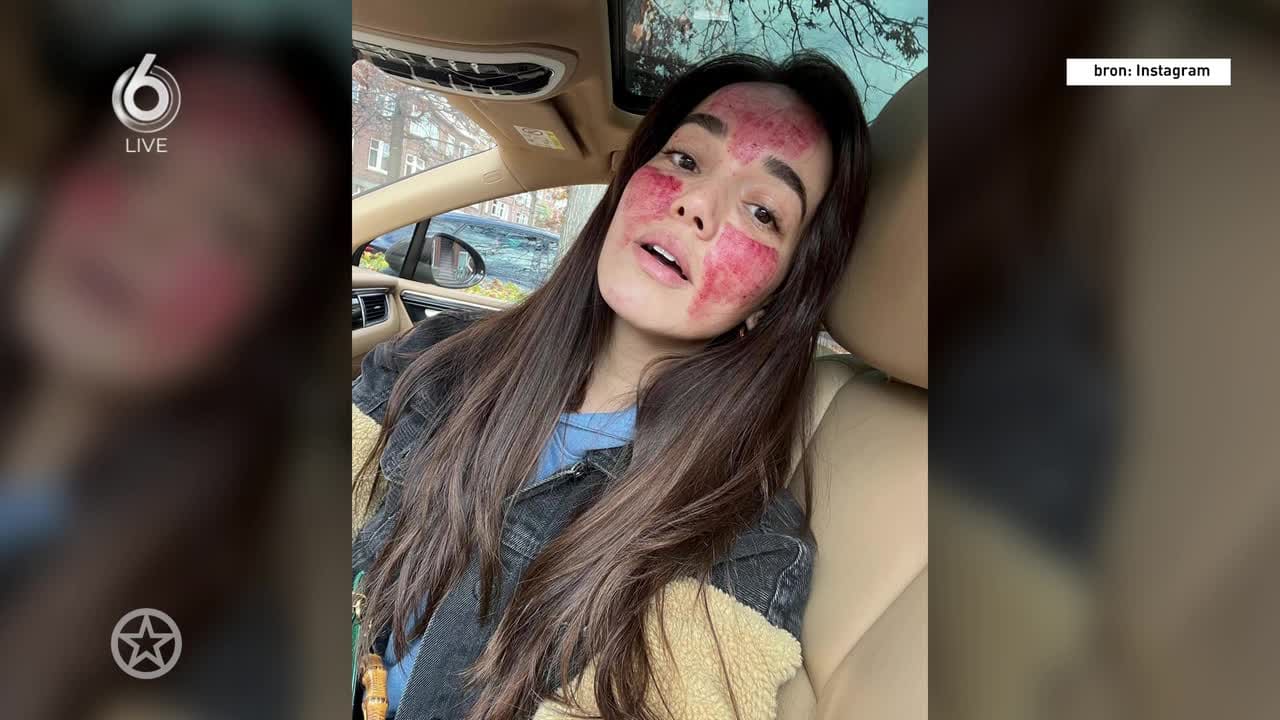 Bibi Breijman onder het bloed