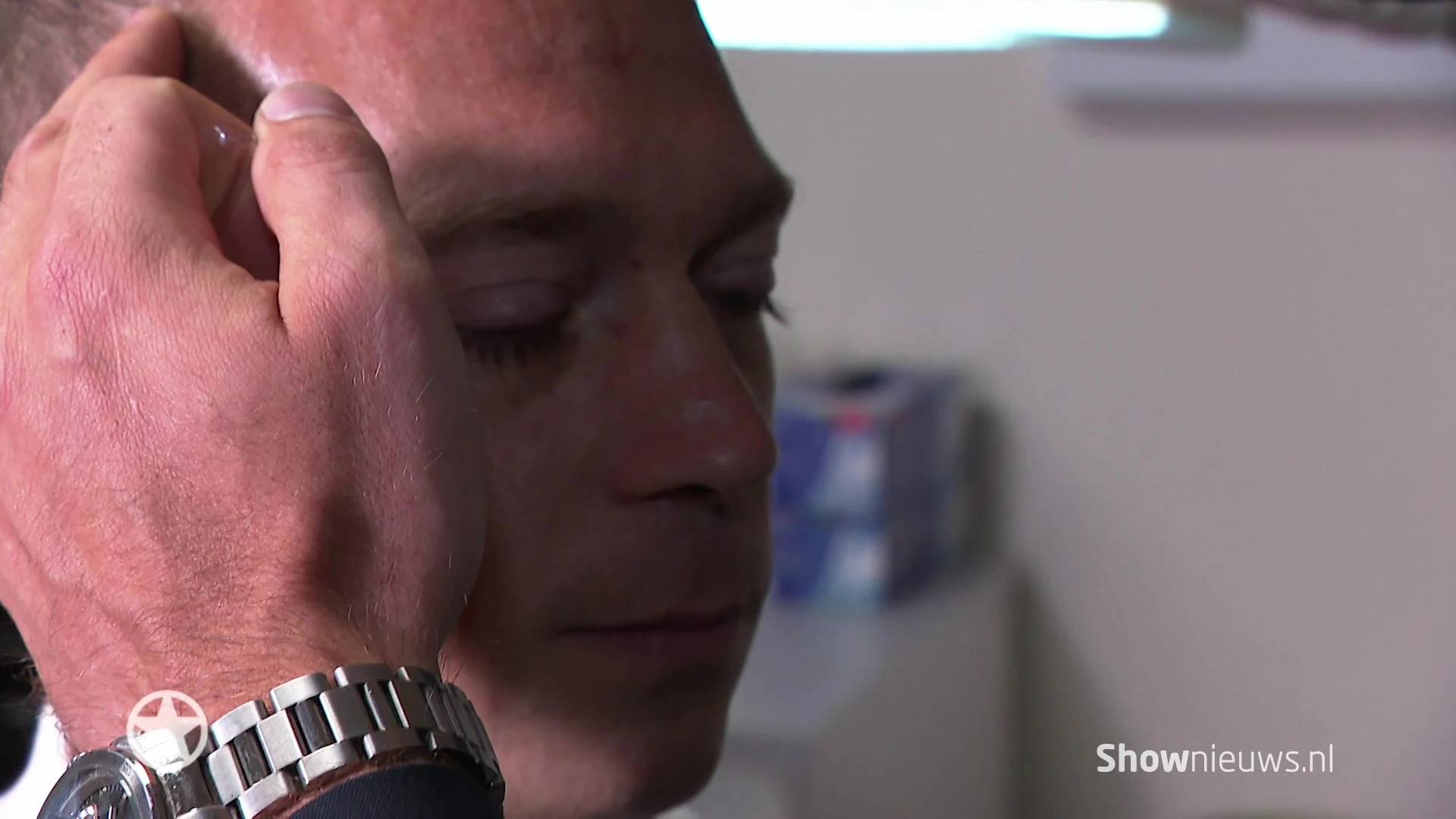 Yuri van Gelder ondergaat haartransplantatie!