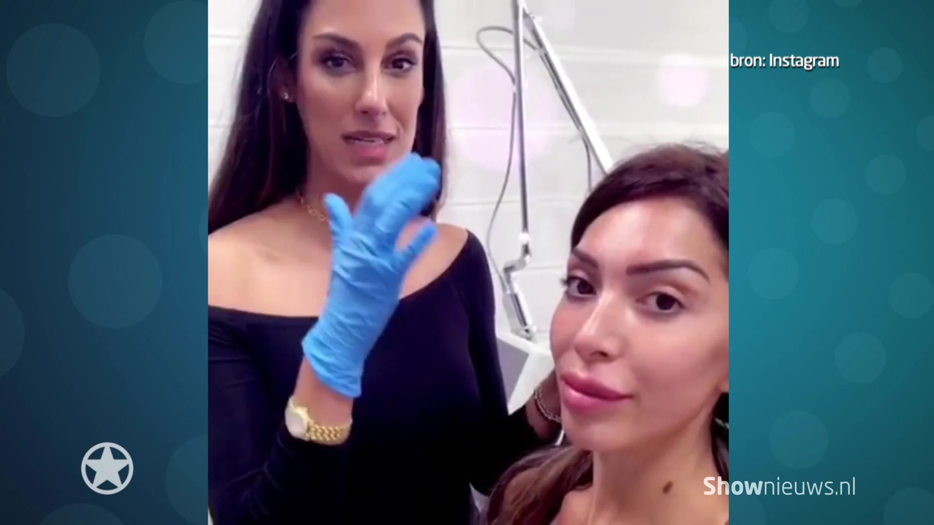 ZIEN! Teen Mom-Farrah laat lipfillers verwijderen