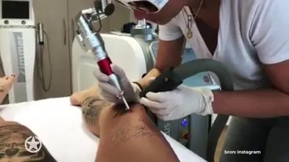 Pommeline verwijdert de naamtattoo van Fabrizio