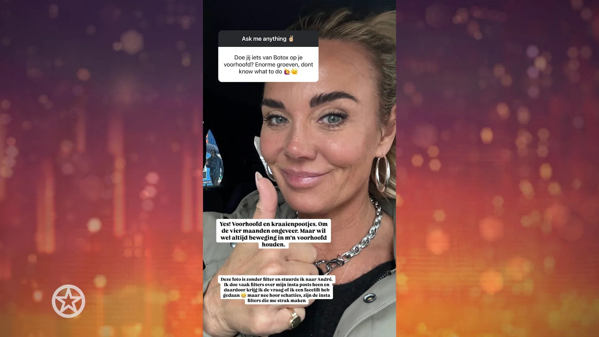 Voor en na foto's neus Monique Westenberg