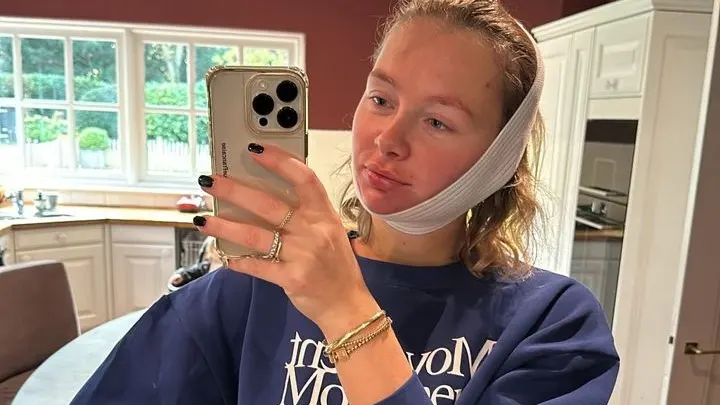 ZIEN: Zo ziet Maxime Meiland eruit na haar cosmetische ingreep