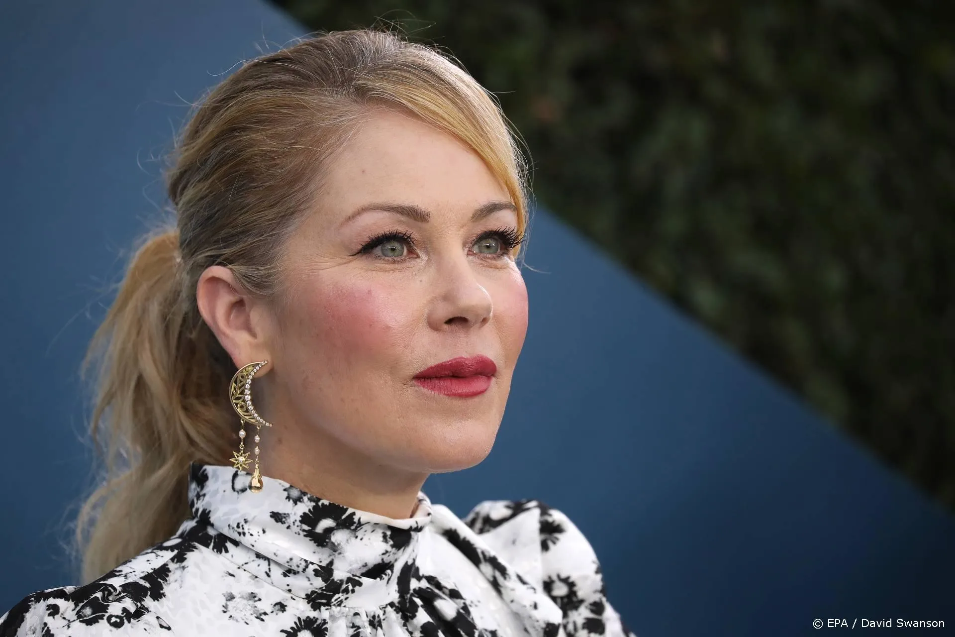 Actrice Christina Applegate (49) heeft MS