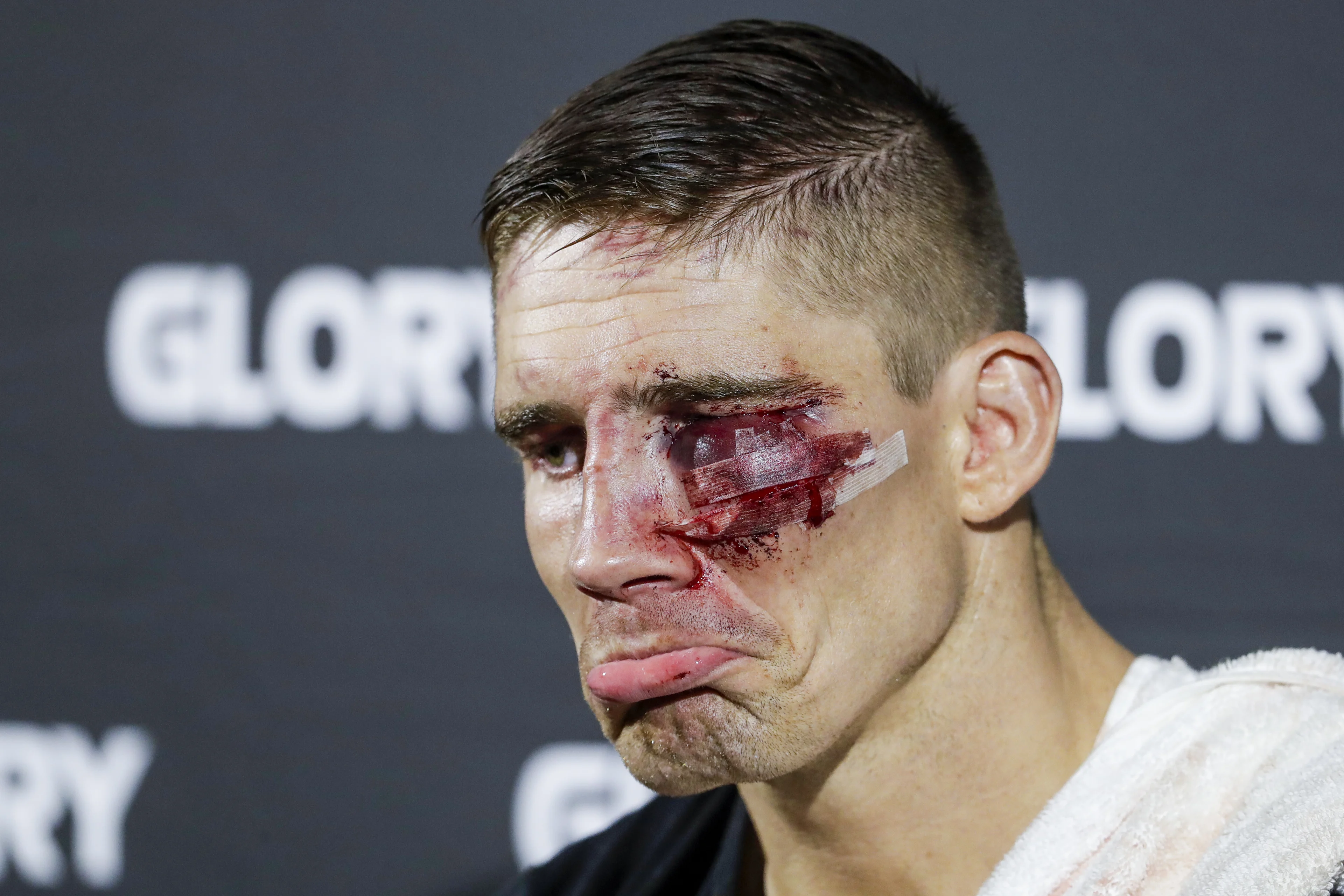 Rico Verhoeven flink toegetakeld na gevecht met Jamal Ben Saddik