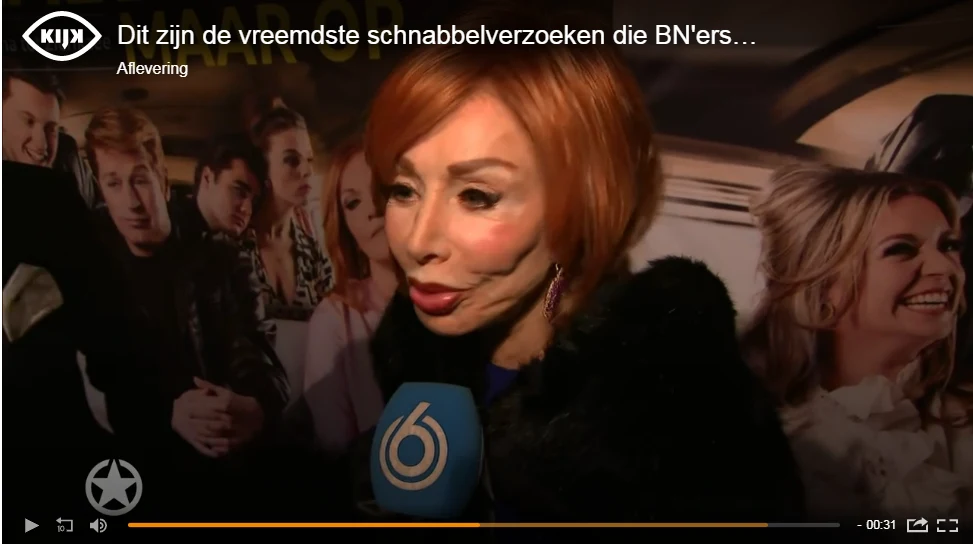 Dit zijn de vreemdste schnabbelverzoeken die BN'ers krijgen