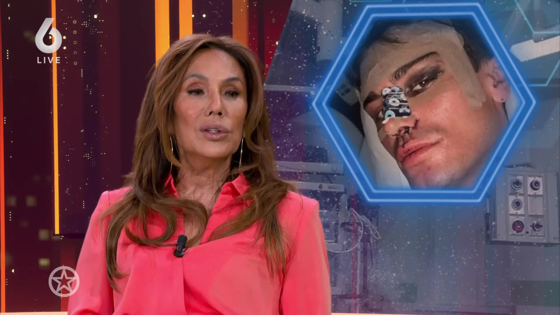 Koen Kardashian ondergaat neuscorrectie