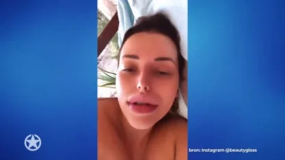 BALEN: Deze BN'er ligt ziek op bed tijdens vakantie