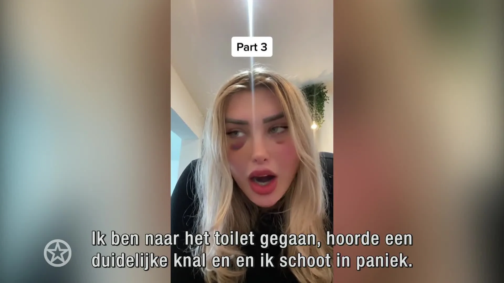 Gezicht Britse influencer 'ontploft' vliegtuig