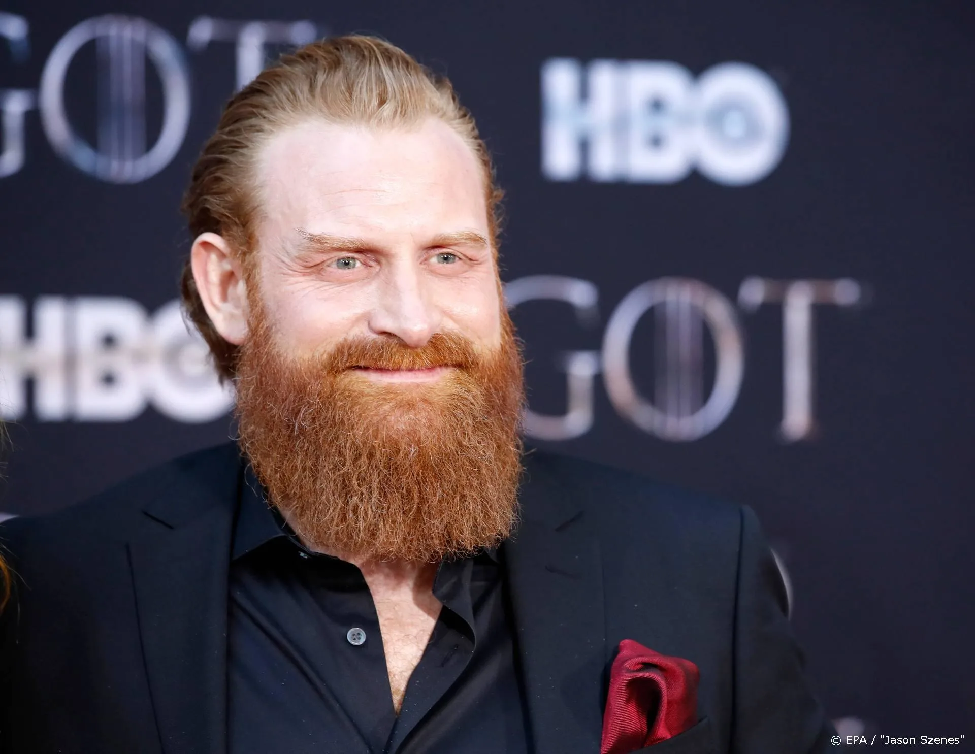Game Of Thrones-ster Kristofer Hivju heeft corona