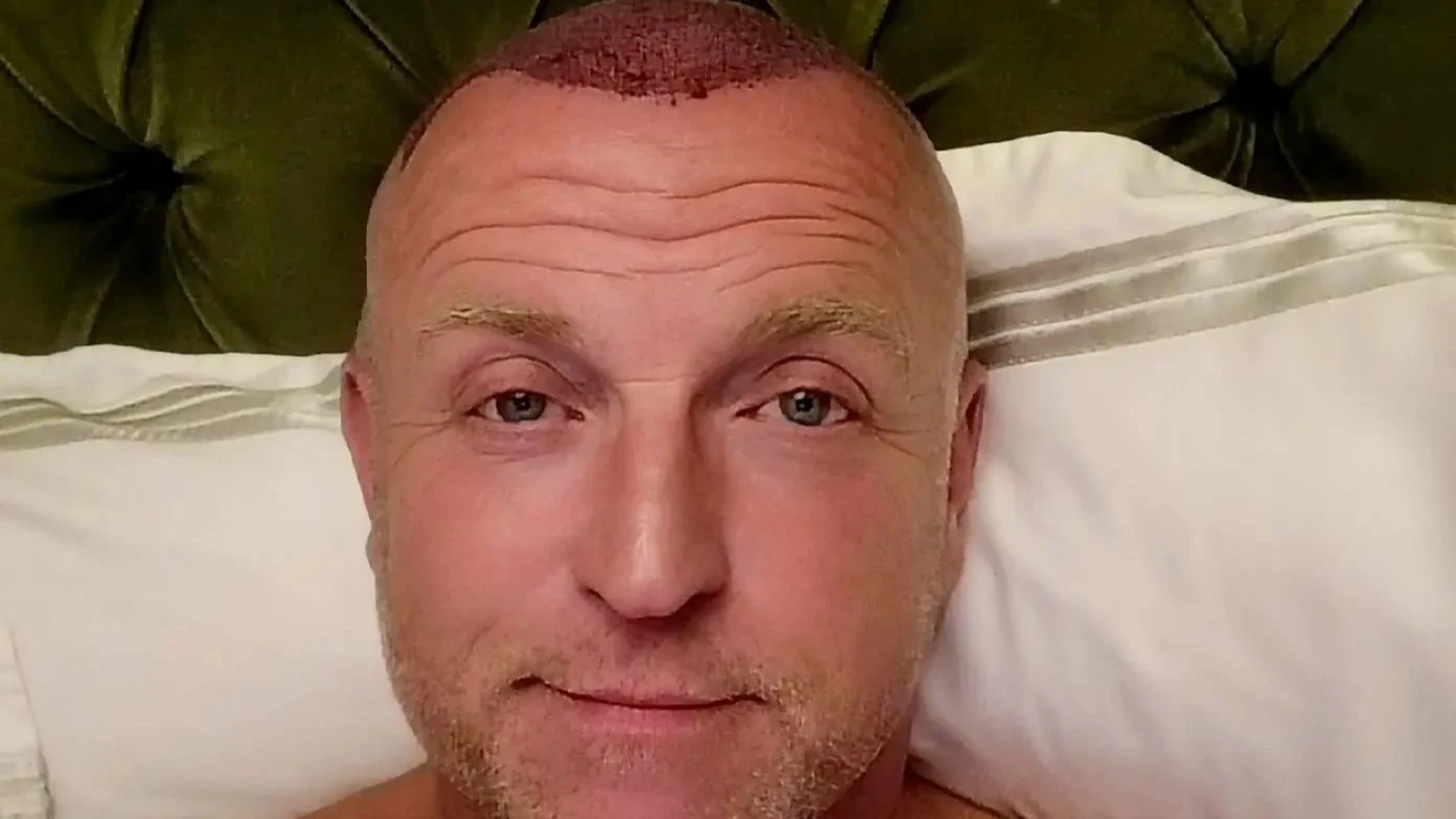 Gordon toont zijn coupe voor het eerst na haartransplantatie