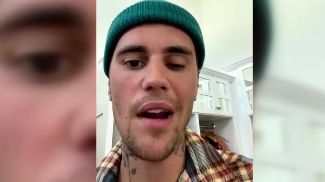 Justin Biebers gezicht deels verlamd: 'Is behoorlijk serieus"