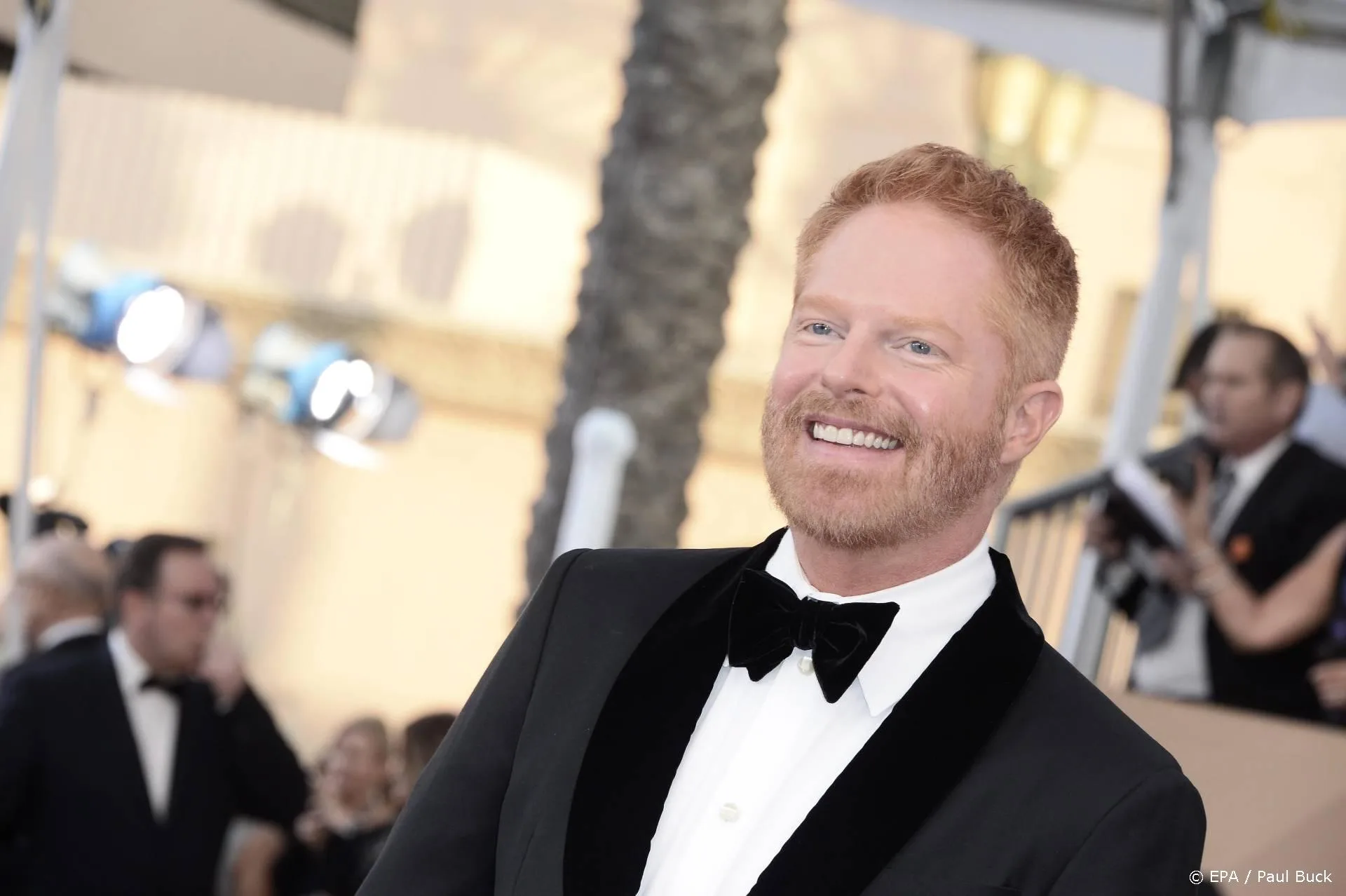 Modern Family-acteur behandeld voor huidkanker