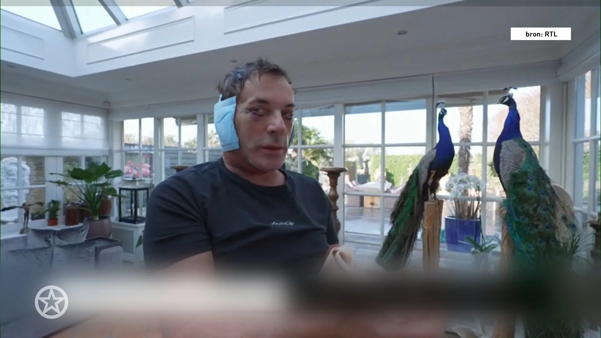 Reacties op cosmetische ingreep Gerard Joling