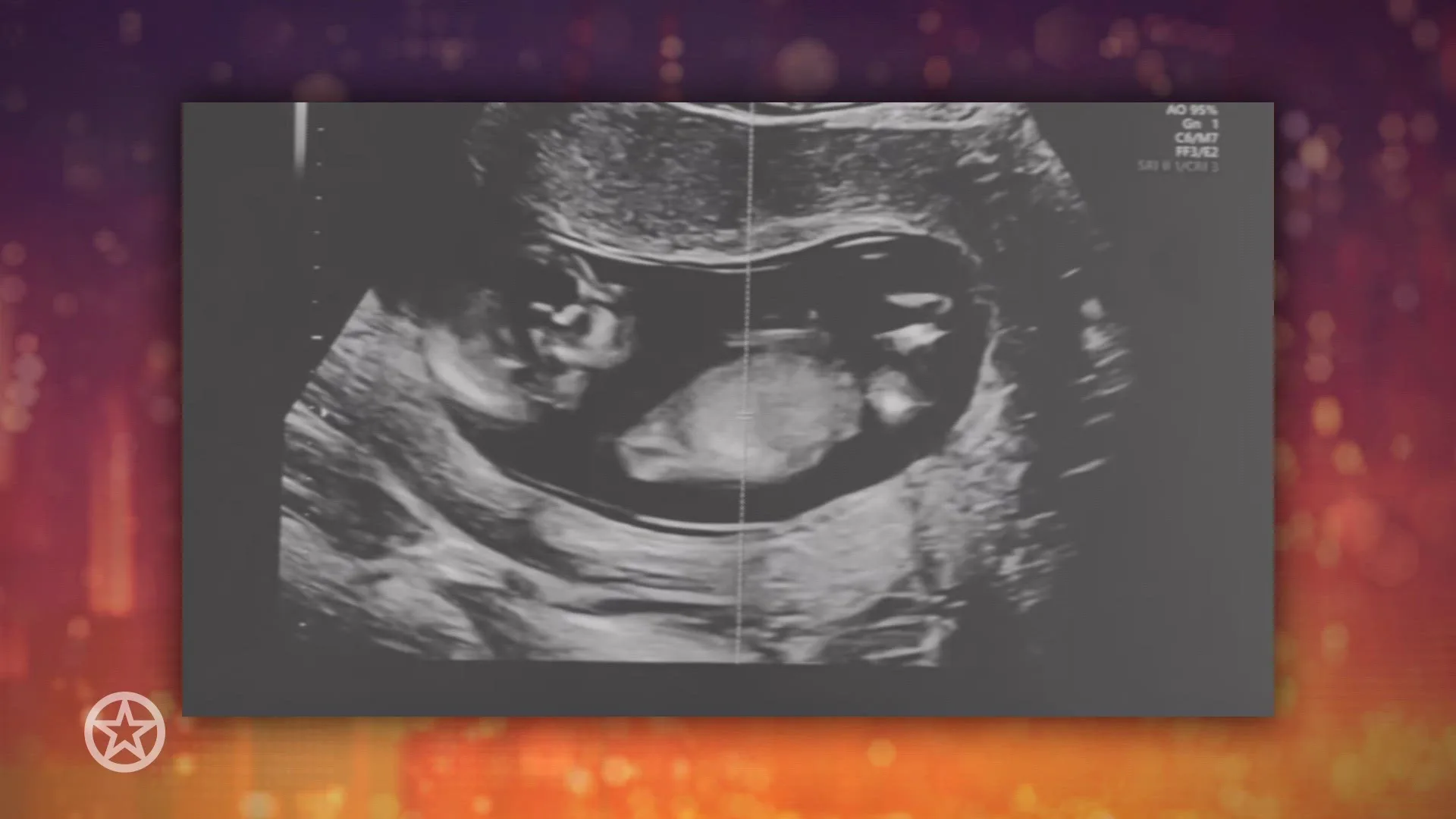 Romy de Boer maakt eerste zwangerschap bekend