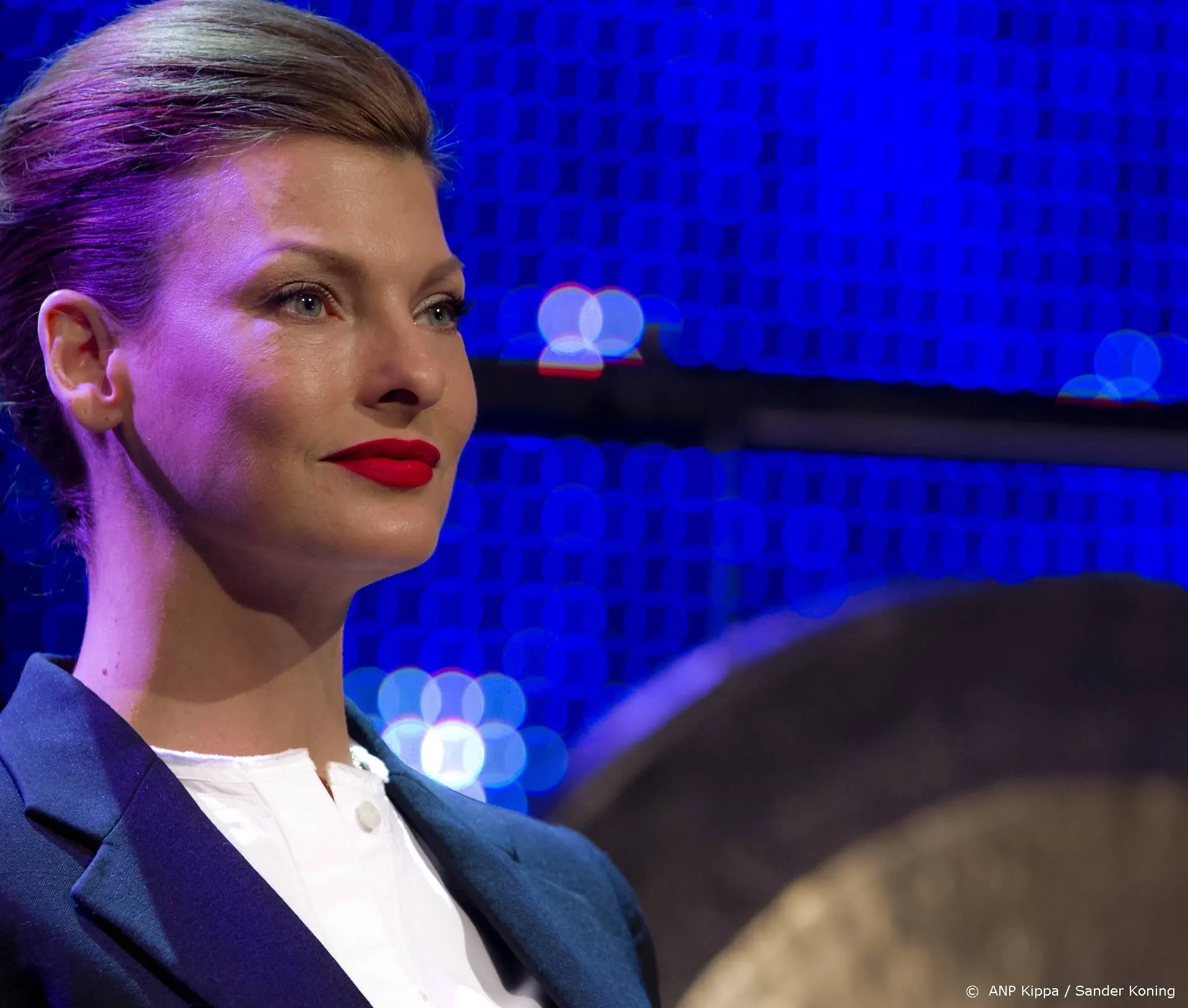 Linda Evangelista 'misvormd' na mislukte cosmetische ingreep