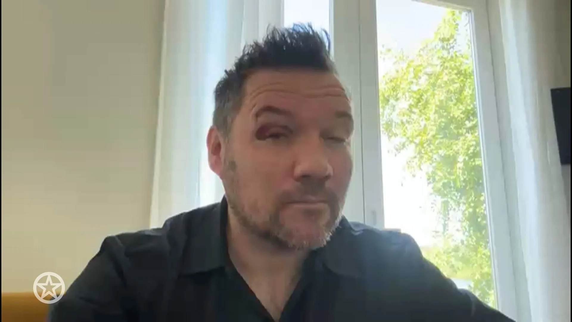 Klaas van der Eerden over ongelukje tijdens voorstelling: 'Bloed stroomde uit wenkbrauw''