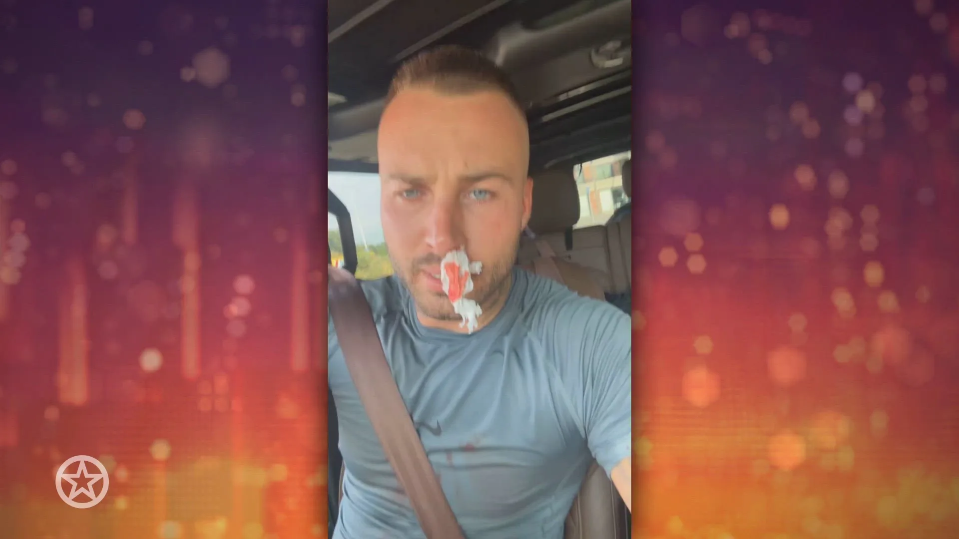 Dave Roelvink breekt zijn neus