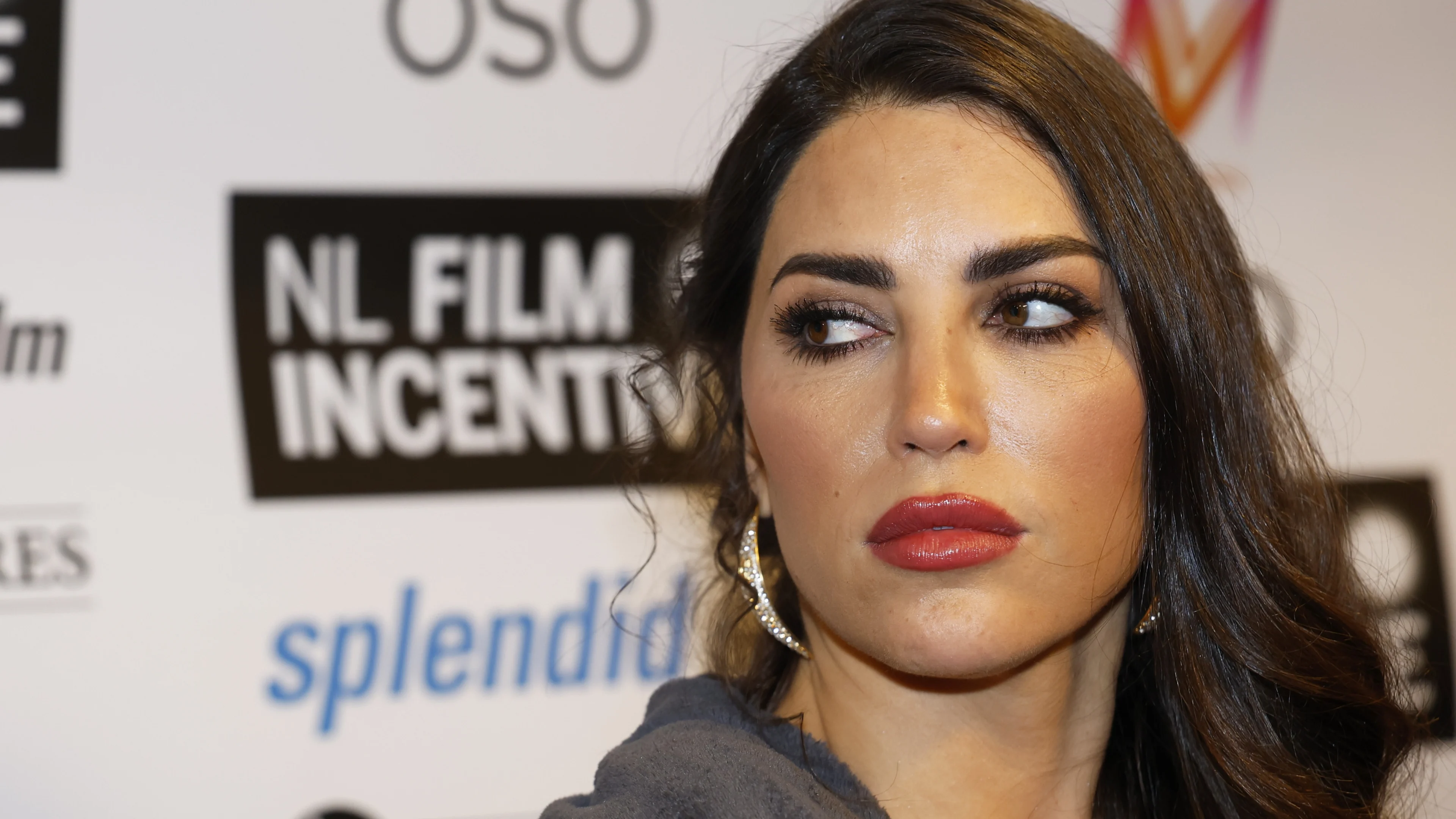 Yolanthe Cabau open over nasleep van heftig ongeluk