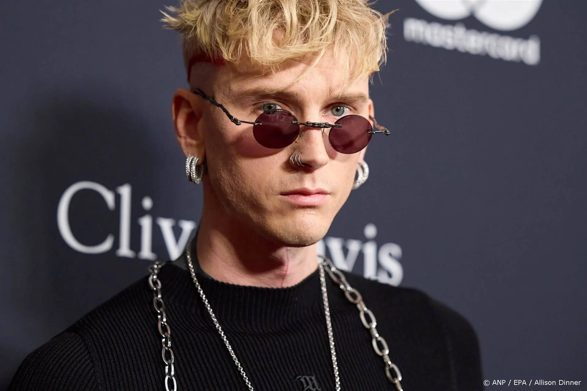 ZIEN: Deze artiest ondergaat bizarre behandeling