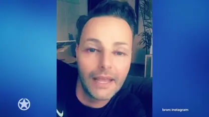 Deze mannelijke BN'ers hebben geen moeite met plastische chirurgie