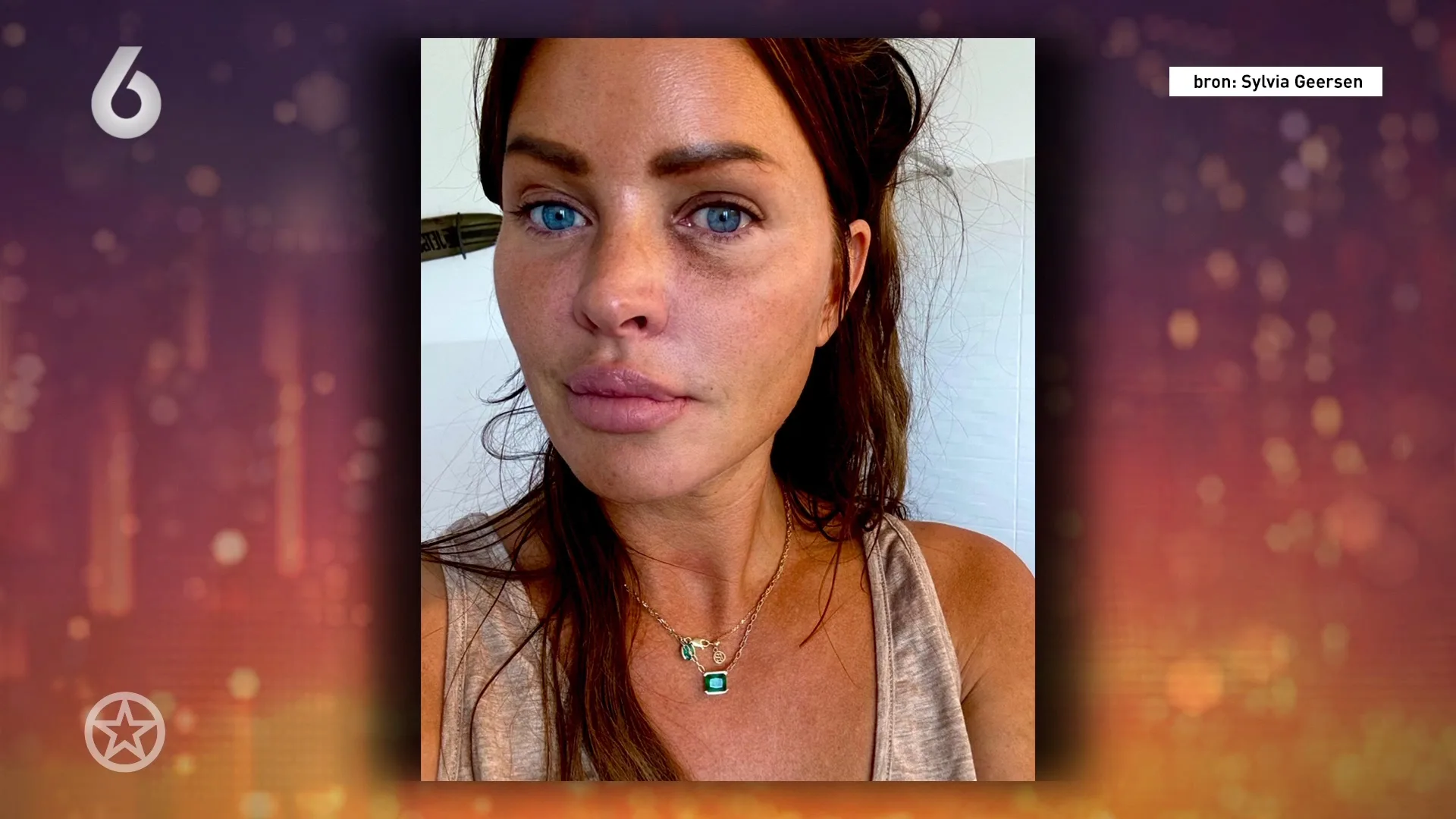 Sylvia Geersen openhartig over vechtpartij bij Brasserie Casa Hazes